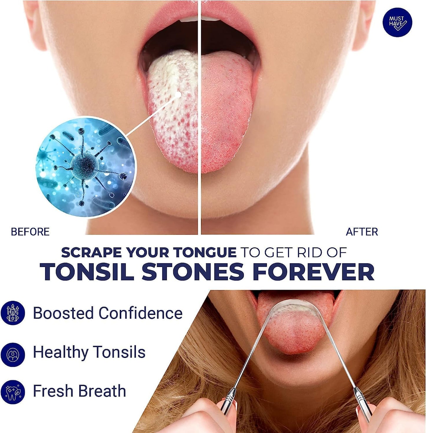 ORAVIX Tonsil Stone Removal Kit - Remover Fast Painless Tonsillolith Tool Cleaner Fight Bad Breath Oral Irrigator Tongue Scraper 7 Pieces